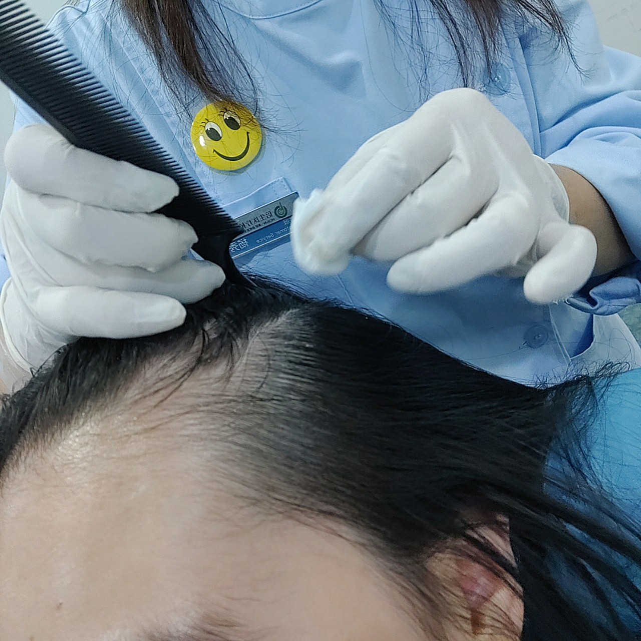 伊诺锶黄金微针特思嘉头皮水光瓶头皮联合抗衰第三弹.