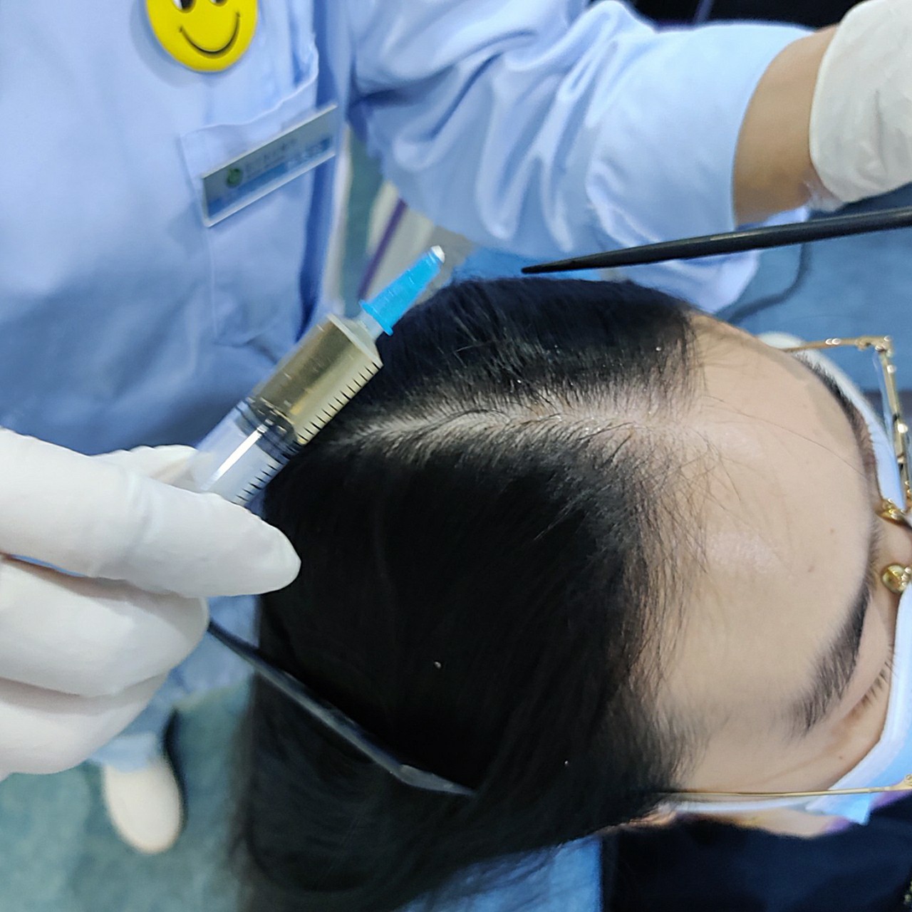 伊诺锶黄金微针特思嘉头皮水光瓶头皮联合抗衰第三弹.