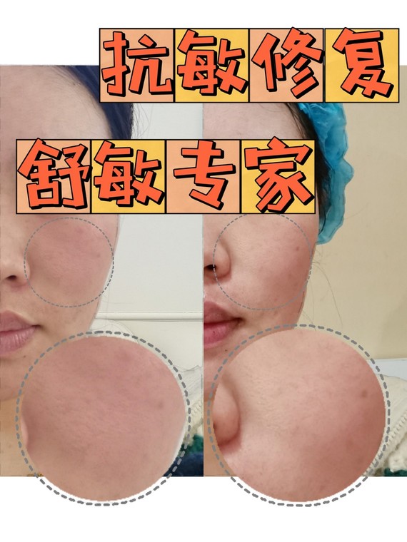 舒敏专家真的这么鸡肋嘛07