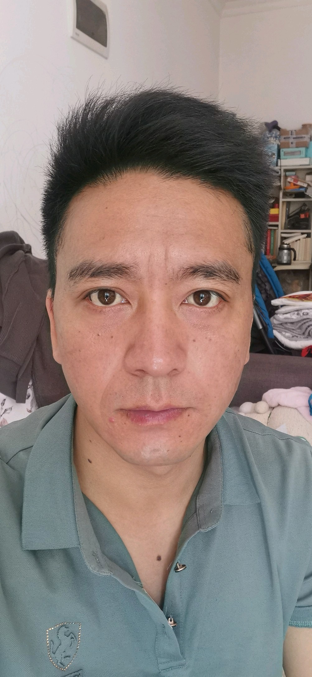 我的法令纹川字眉