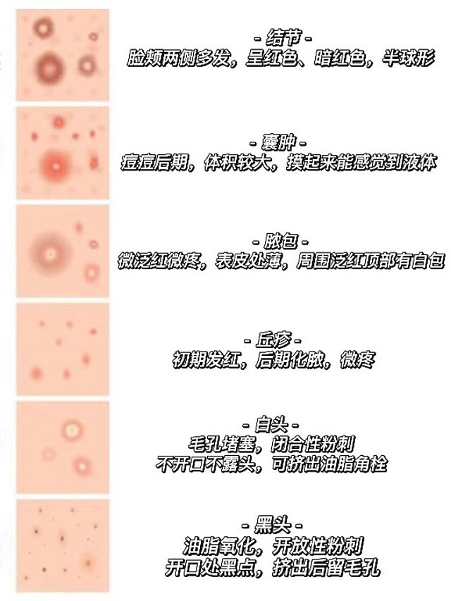 睾丸上白色的痘痘图片图片