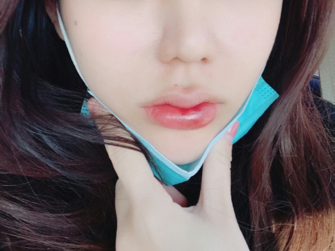 现在肉嘟嘟的唇越来越流行了,其实没有丰唇之前我唇形也是好看