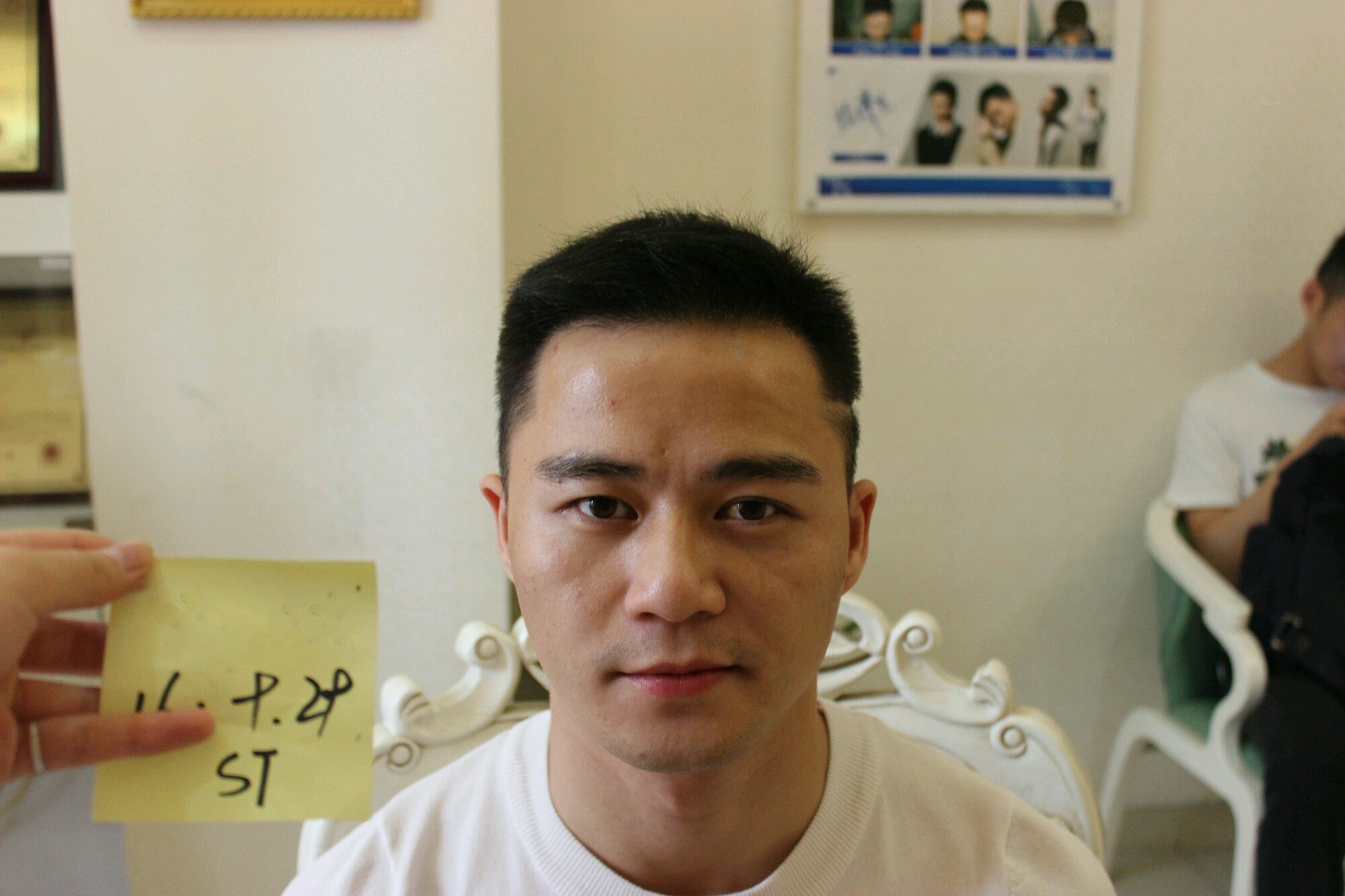 整容植发男上海(上海植发整个头顶多少钱)