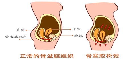 你知道生完孩子屁股变大的罪魁祸首是谁吗后续2