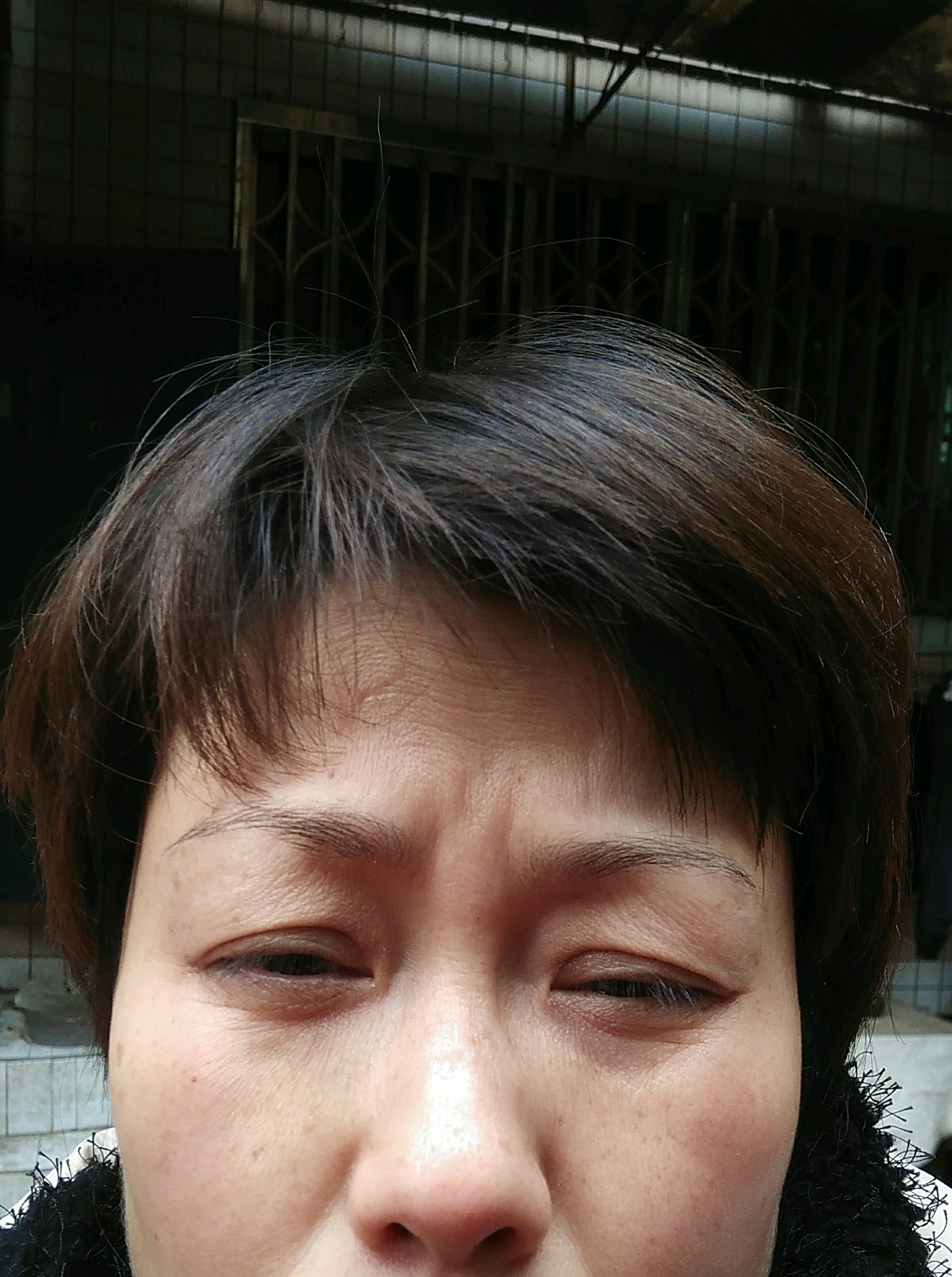 效果刚2个月川字纹现在很明显没有维持到46月明显打的剂量不够