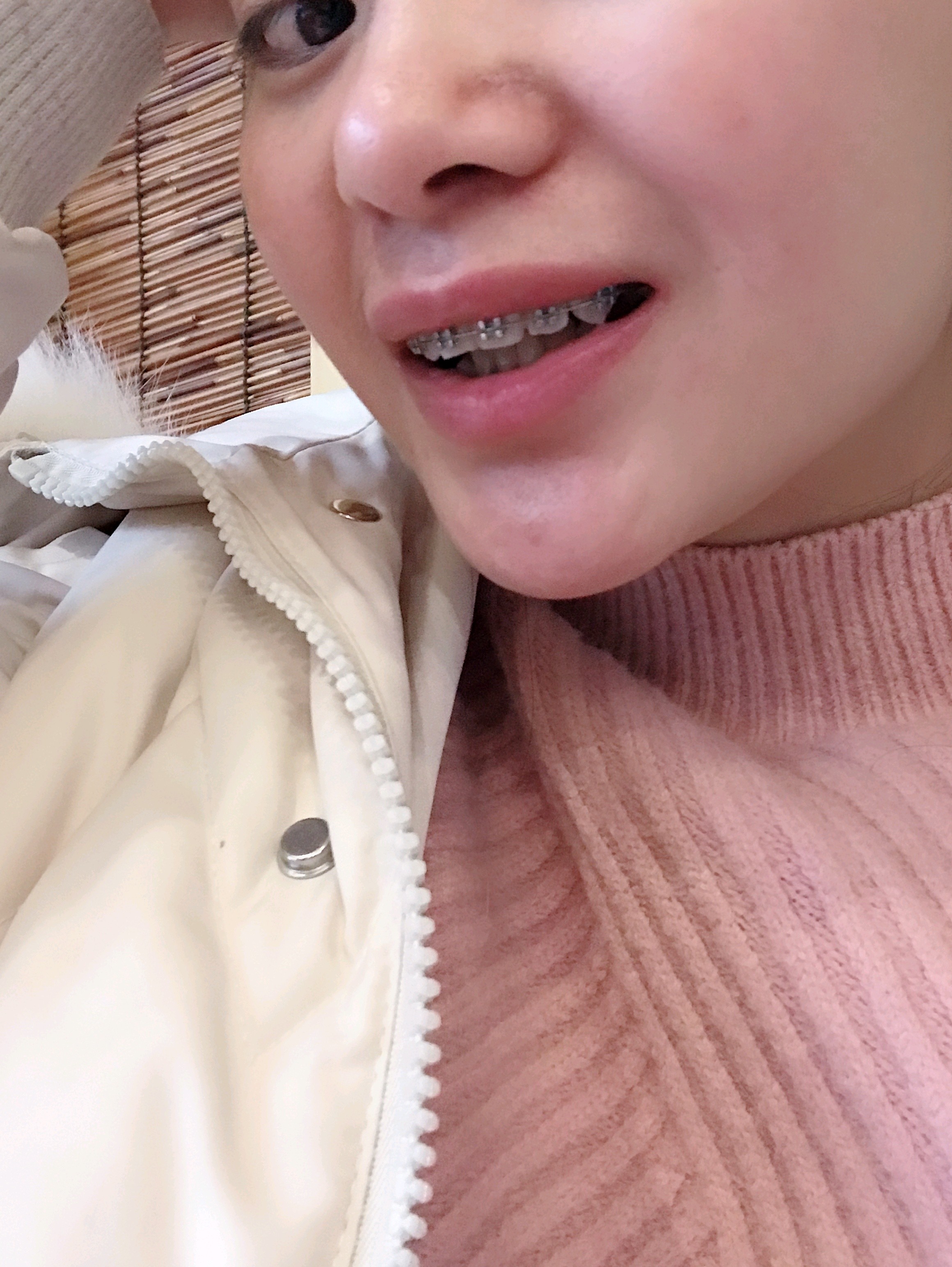 医生小姐姐先是给我设计了治疗方案,又给我看了做完