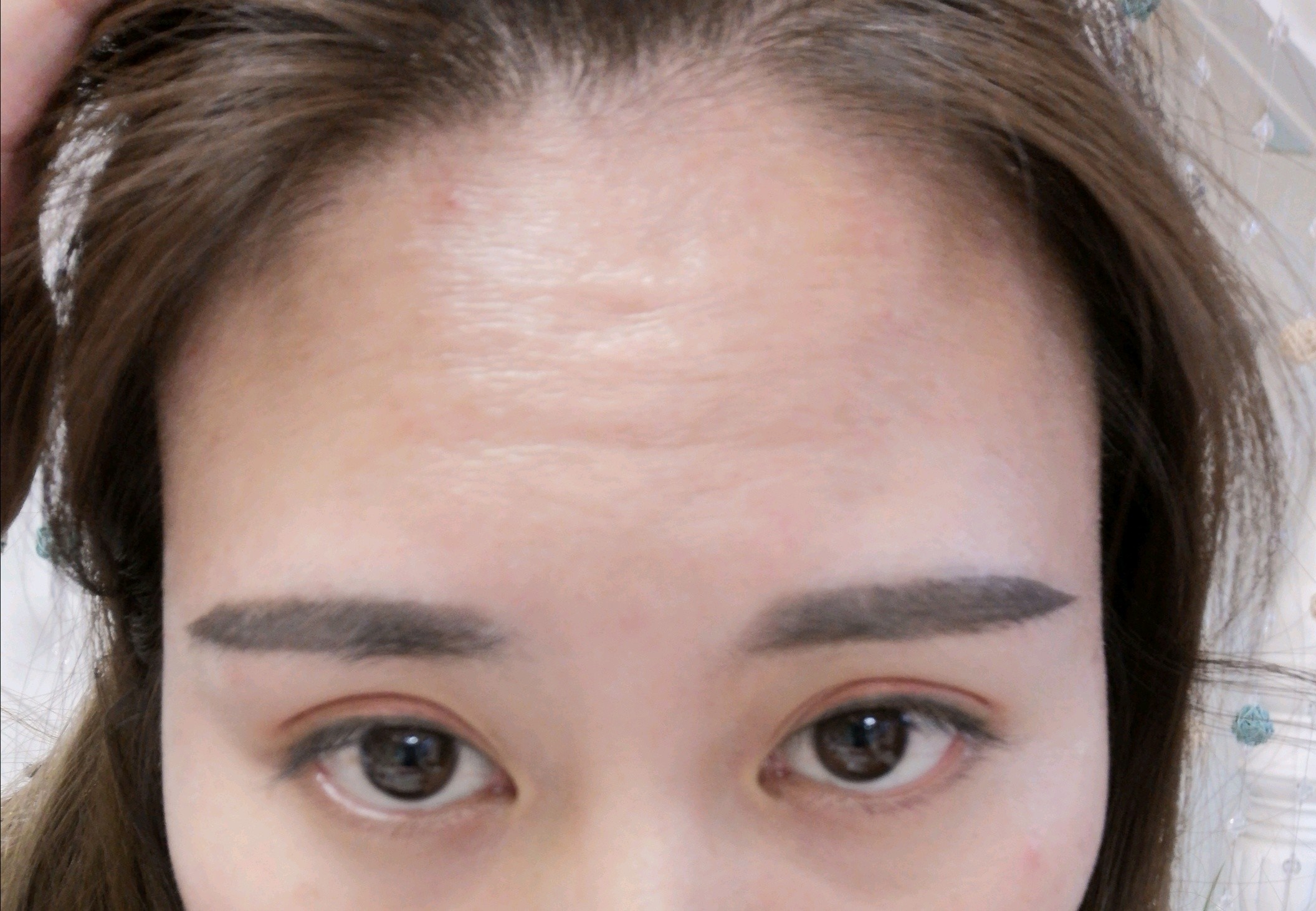 感觉自己抬头纹有点严重的.打之前的照片,期待效果