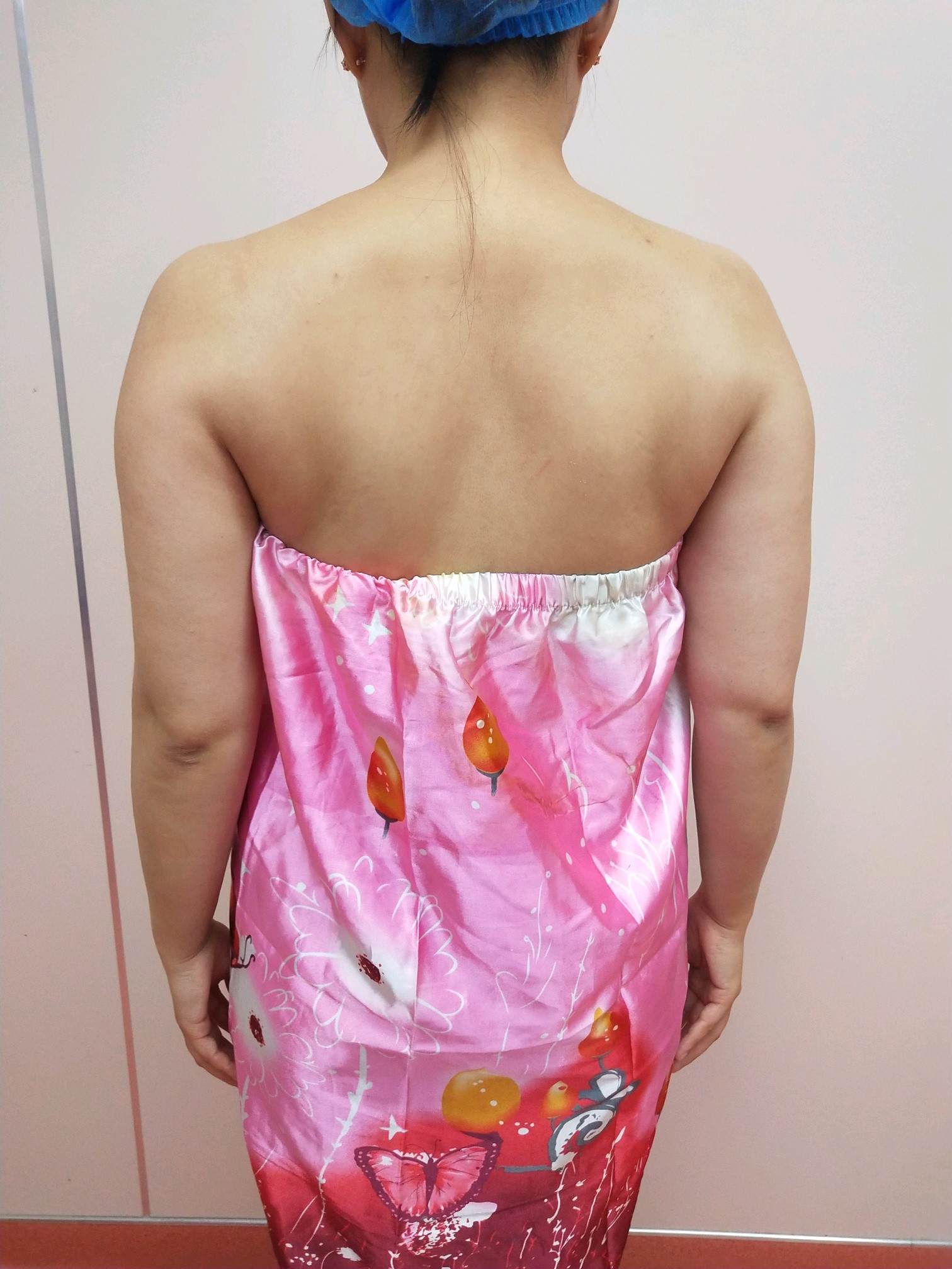 今天来到了驯鹿,医院环境非常好,负责接待的小姐姐超