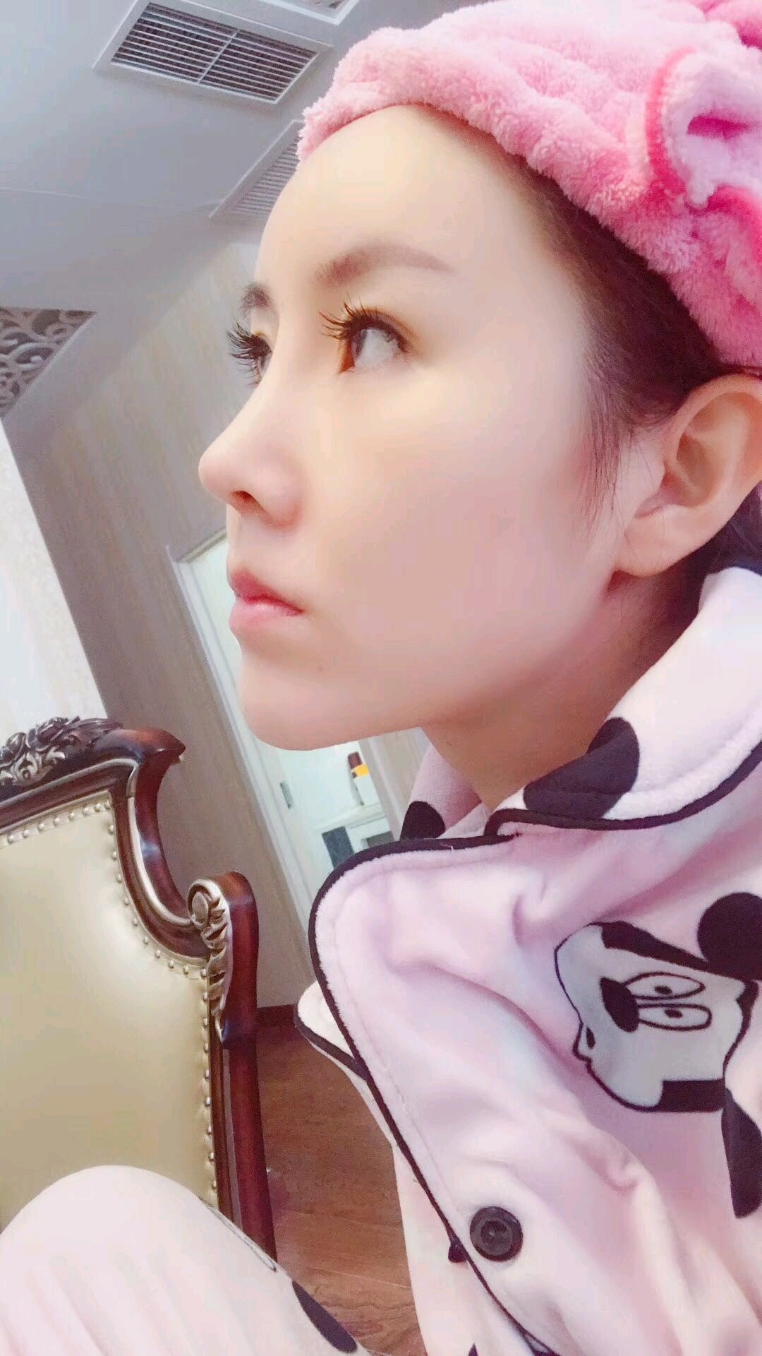 现在做完鼻部多项已经有30天了,从app看到这家医院_圈子-新氧美容整形