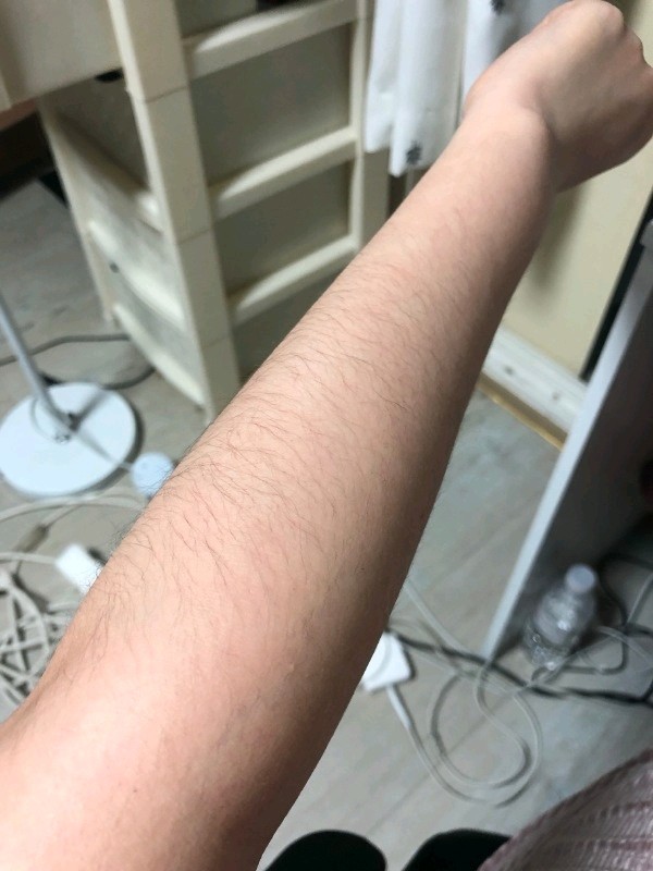 夏天来了 汗毛重真心让我自卑,穿短袖尴尬的不行之前盲目找方法,一直