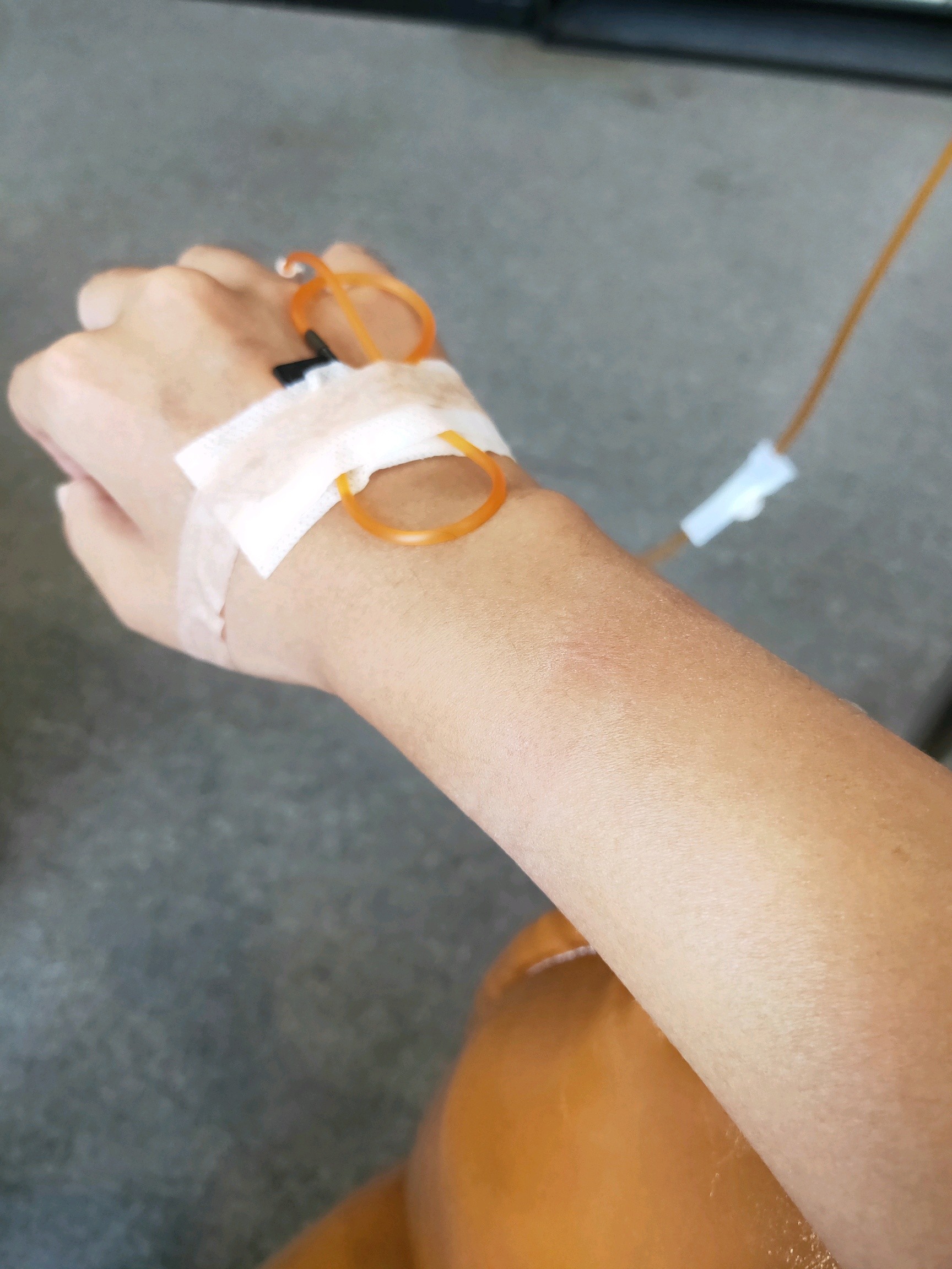 【美白注射】日本铂金美白注射/雪娃娃/晒后修复/解决肤色蜡黄暗沉/护