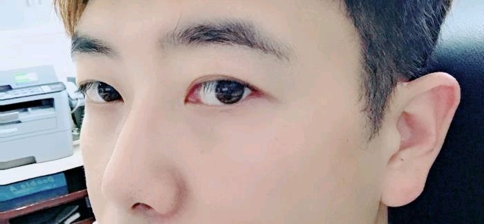 以前的自己是个内双还有点厚眼皮的小眼男生,看到大眼_圈子-新氧美容