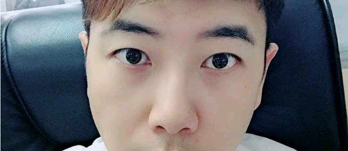 以前的自己是个内双还有点厚眼皮的小眼男生,看到大眼_圈子-新氧美容