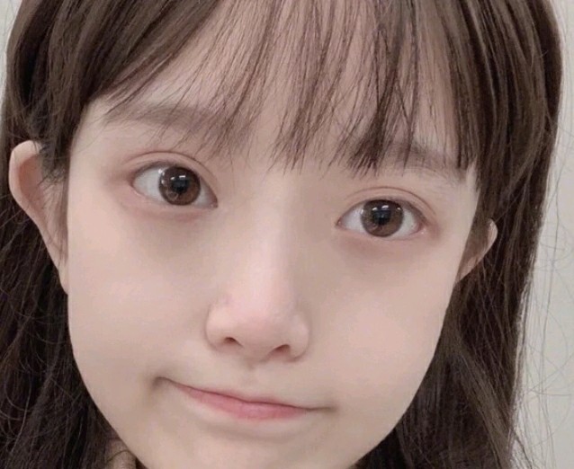 特别喜欢日本那种芭比无辜眼,但是也要自然点,别太夸_圈子-新氧美容