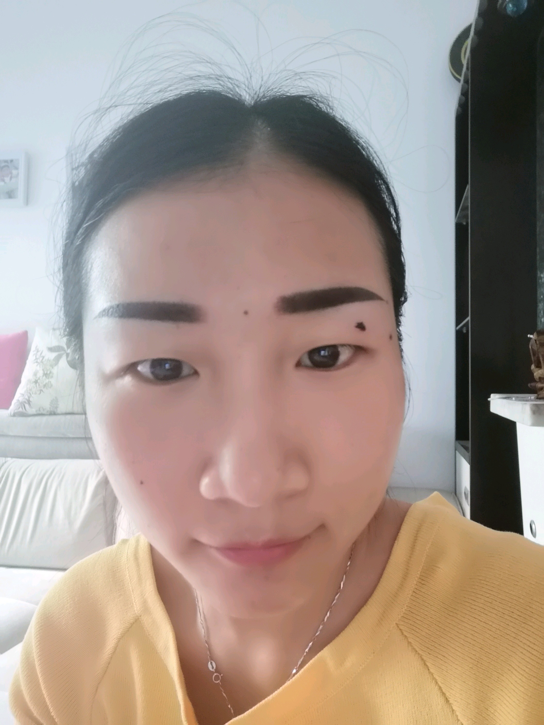 纹眉后第二天了,颜色还是很深,看起来不自然,希望掉痂后能好看