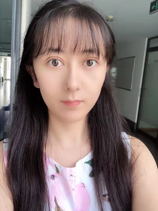 【切开双眼皮】【巡诊专家:靳小雷】成形快,恢复期短,闭眼隐痕 微创双