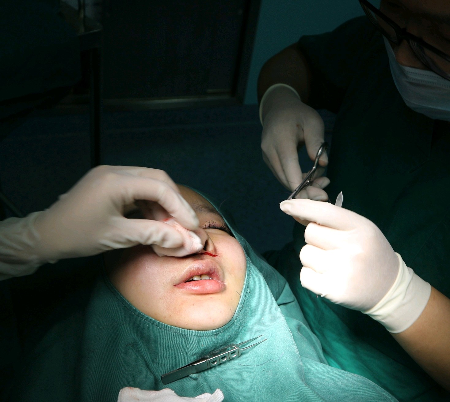 人中太长看起来很严肃,一直都想找个好一点的医院,后_圈子-新氧美容