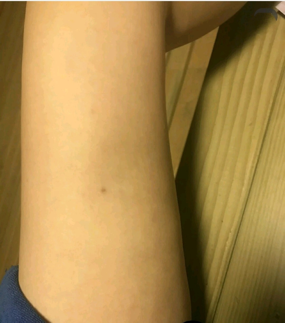 腿一抬起来就会有明显凹凸不平,不抬可能肉比较松看