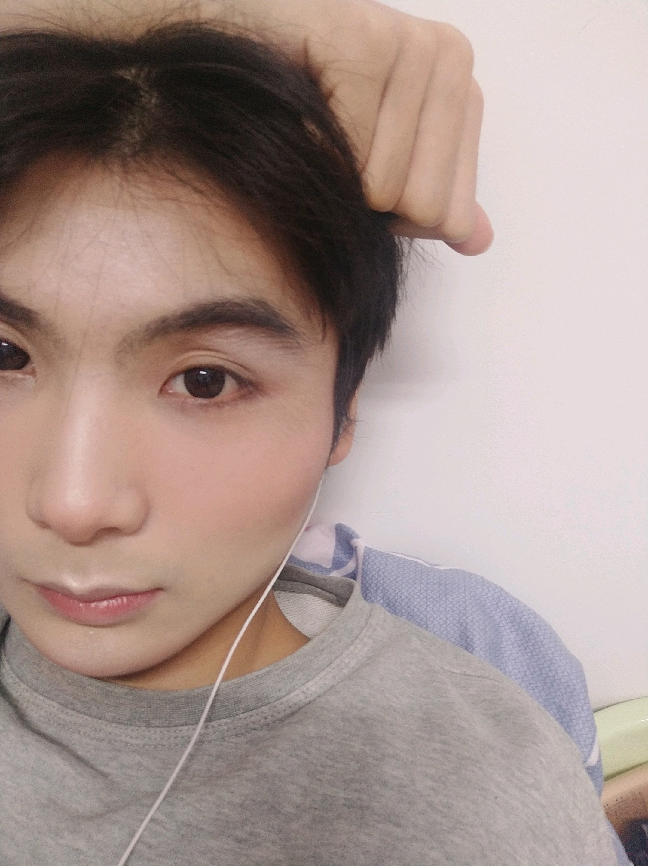 【玻尿酸】1ml海薇海薇m 爆款推荐 ①大分子玻尿酸②填充面部凹陷③