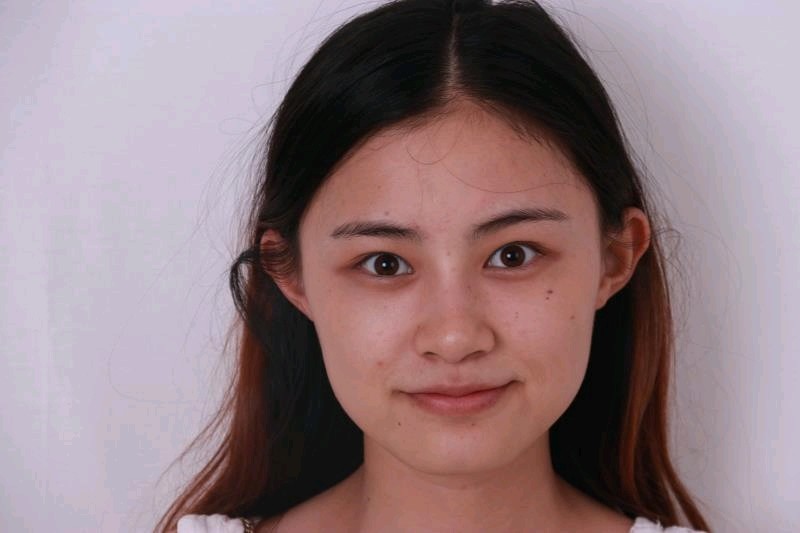 一直觉得自己面部比较扁平,脸有点大,鼻子也是真的圆_圈子-新氧美容