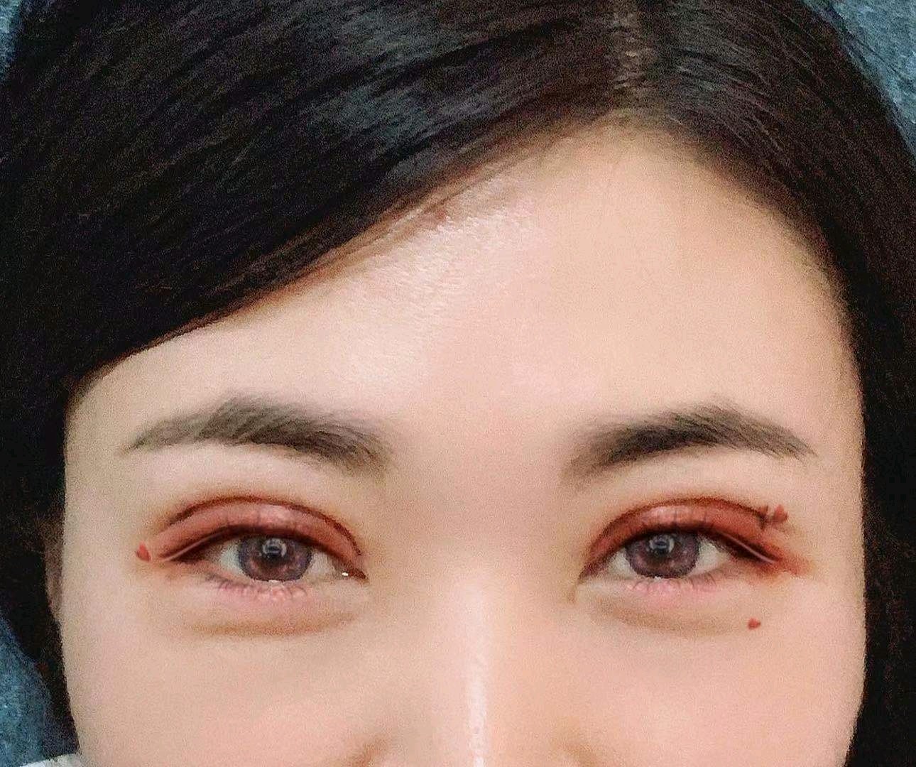 【切开双眼皮】【小月牙裸妆眼】 电眼魔法师@鲁华主任亲自操刀 日式