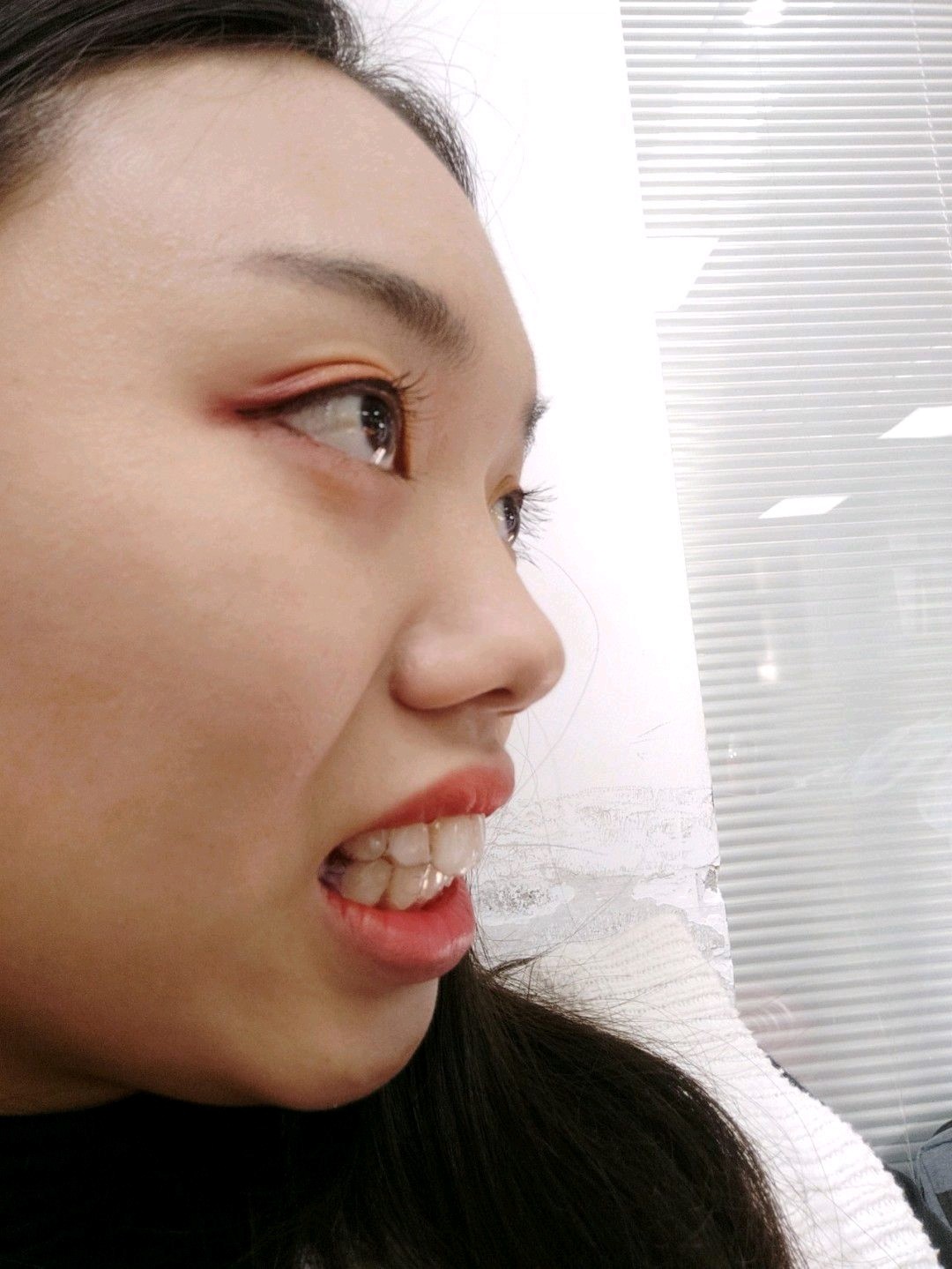 牙齿真的太凸了,而且还不够整齐,真的感觉有点龅牙.