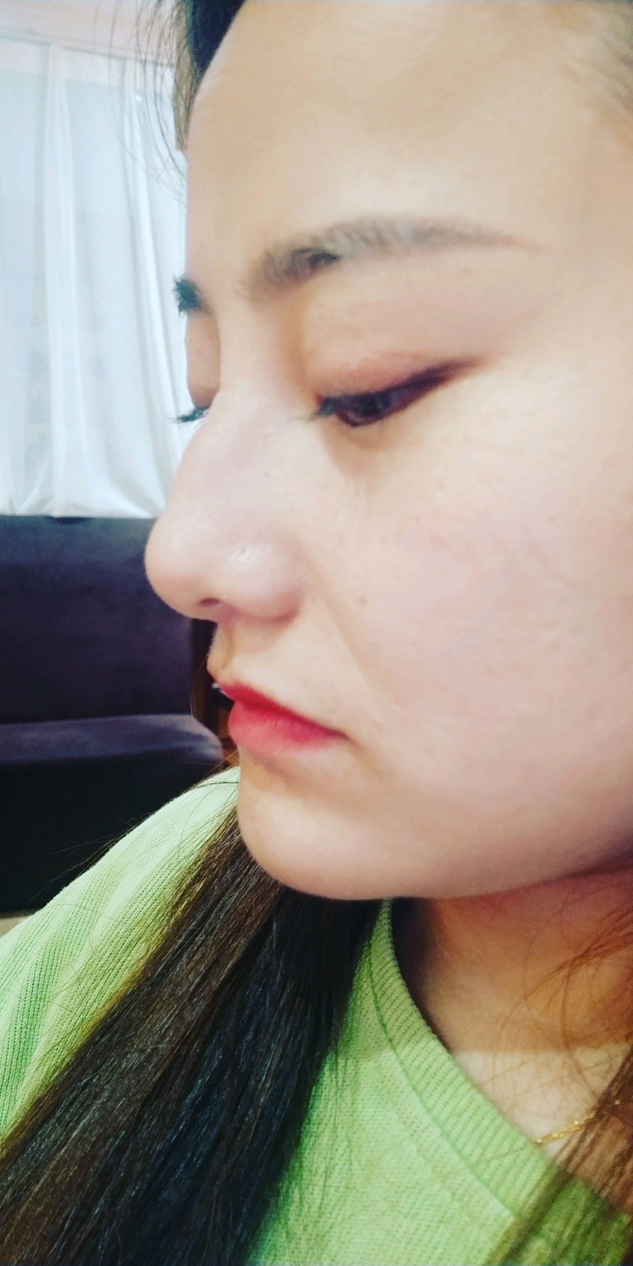 非常不满意,下巴打歪了真的我有强迫症,这明明歪了还_圈子-新氧美容
