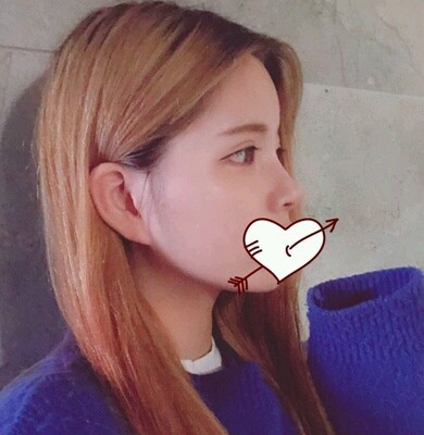 当时本想着就做个单纯鼻子垫高,医生提出了几个方案推_圈子-新氧美容