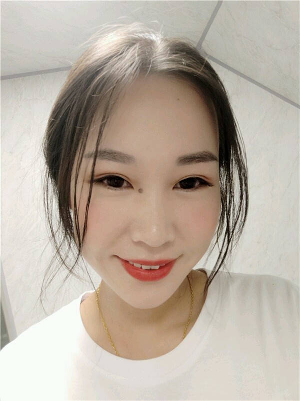 自体软骨 韩式生科假体隆鼻 打造挺,翘美鼻,超自然,垫高鼻梁,侧颜杀