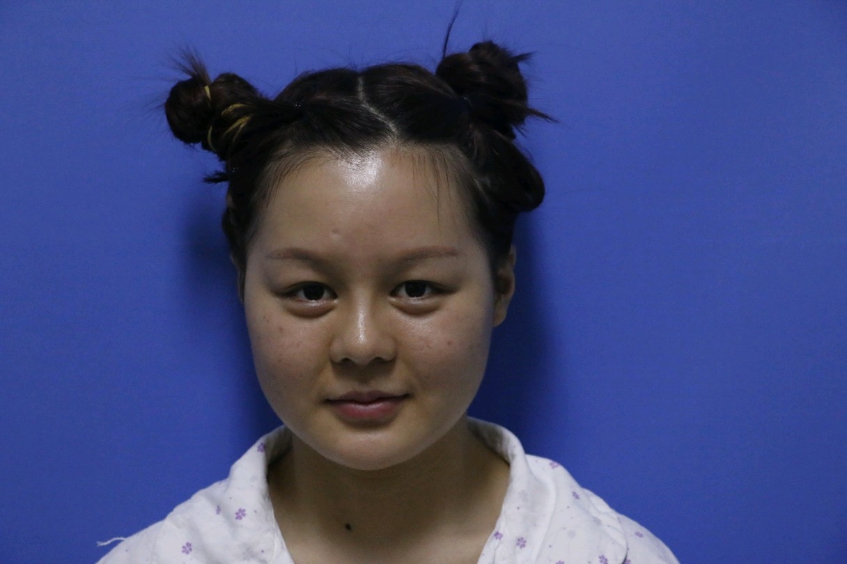 脸肥嘟嘟的像一只生气的河豚,但是没有河豚那么可爱的我与肥嘟嘟的脸