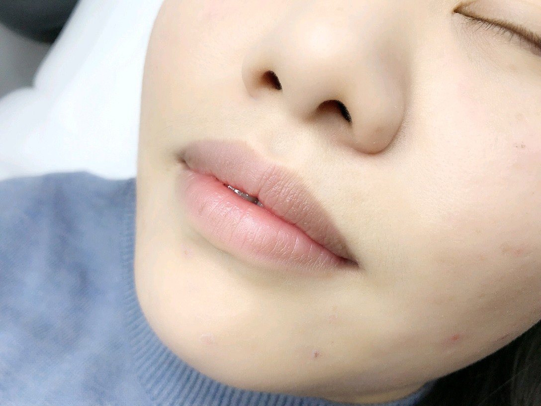 【半永久纹唇】【纹唇】乌唇 黑唇 紫唇 白唇 花唇-新氧美容整形