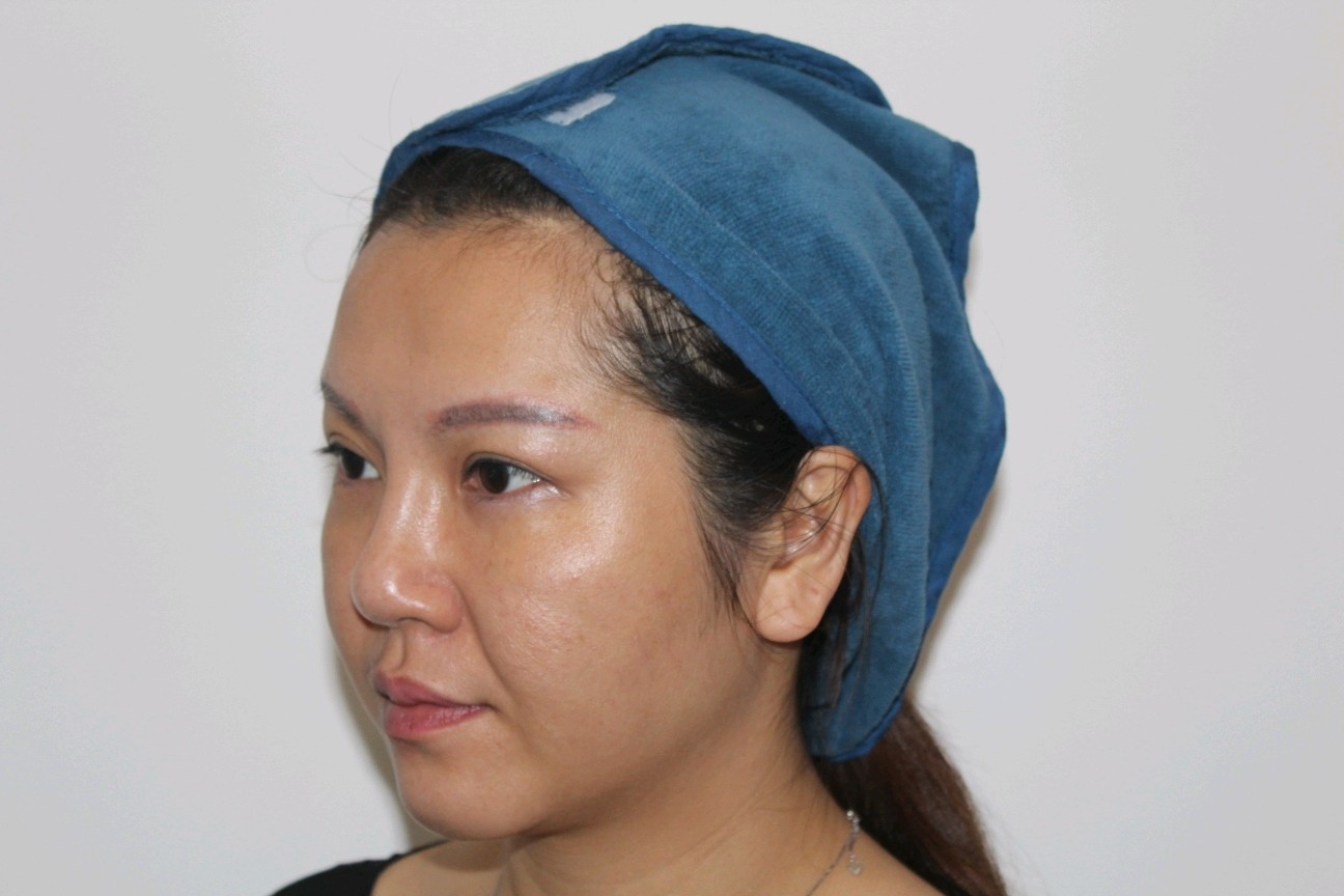 女人一到年龄面部皮肤就开始下垂最近几年感觉自己老的特别快然后就来