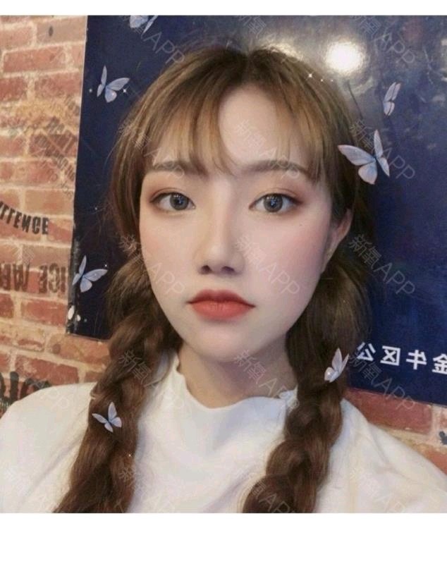 光子嫩肤m22王者之心嫩肤模式进口m22嫩肤美白改善毛孔粗大红血丝