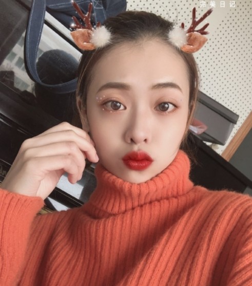 【光子嫩肤】【王者之心m22】【下单即送补水月卡】光子嫩肤祛斑/红