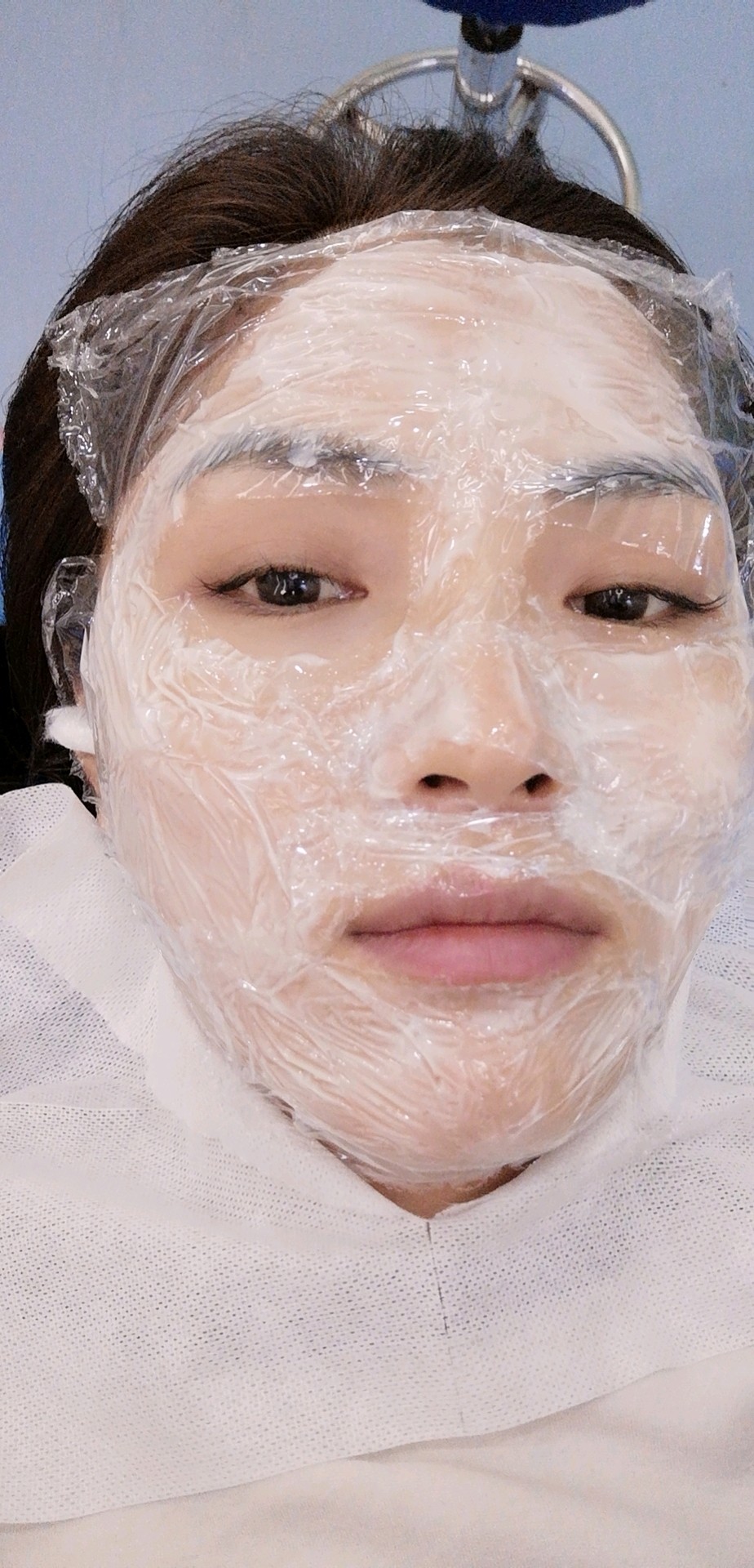 第n次打基础水光,这次打完鼓包有点严重,效果段时间_圈子-新氧美容