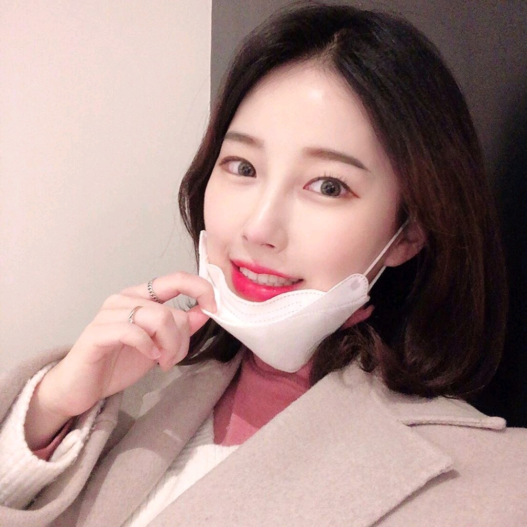 门牙有点偏大,牙齿颜色前后有点不一样,做贴面是看了_圈子-新氧美容