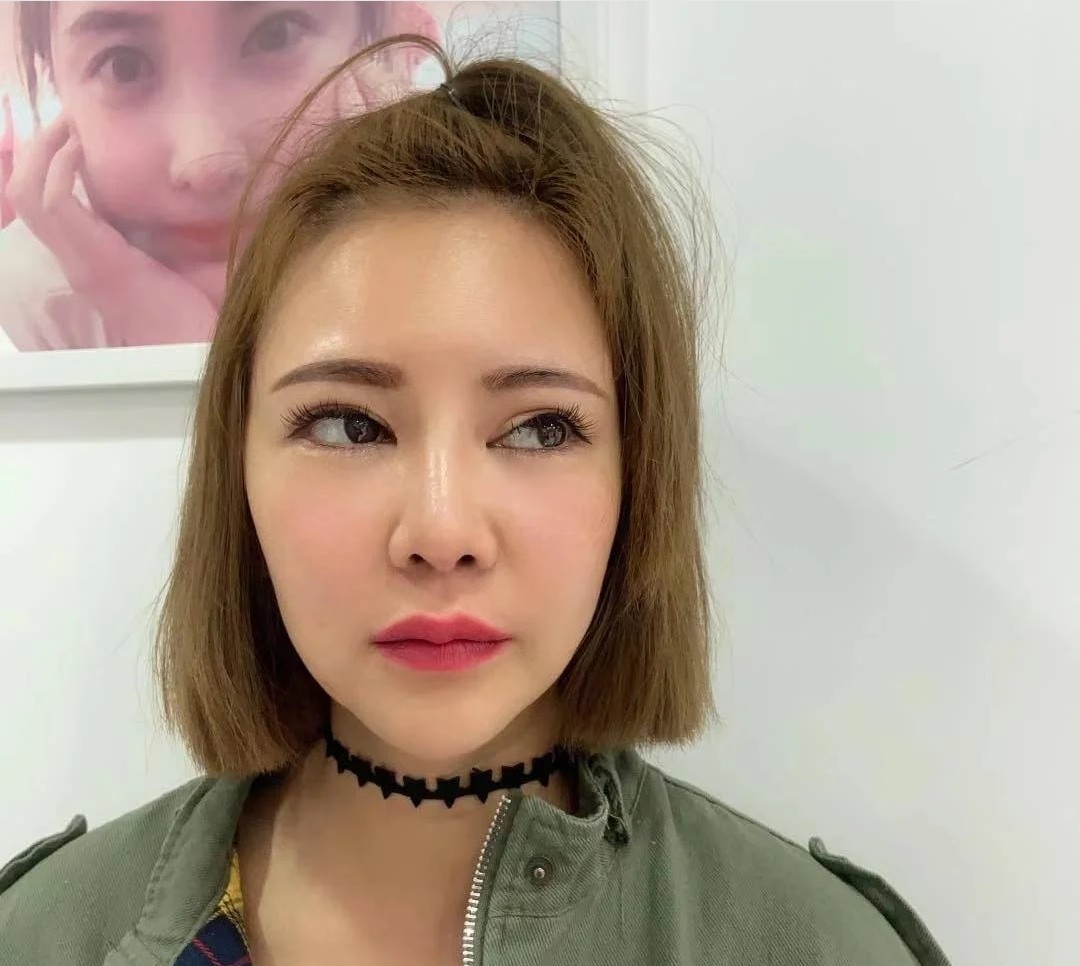 【硅胶垫下巴】塑造精致迷人小v脸 打造兜财下巴 让你拥有美丽侧颜