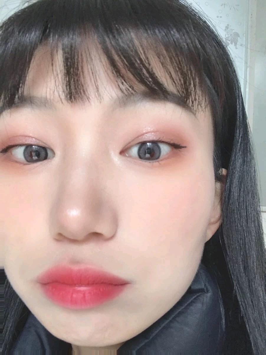 自小看见别人的双眼皮大眼睛,我就问妈妈,我能不能变_圈子-新氧美容