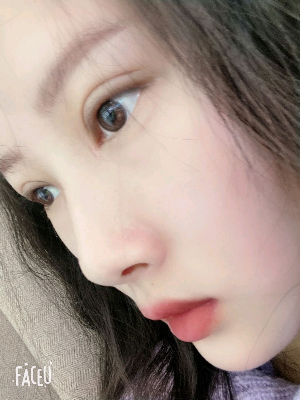 【切开双眼皮】韩式少女眼 超细致全切重睑术 创伤小 恢复快 清新自然
