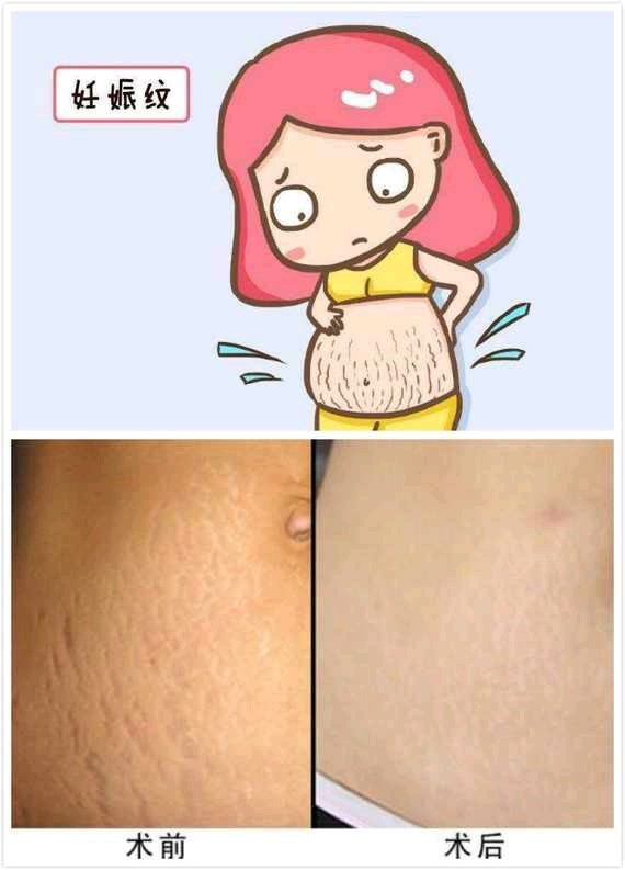 现在非常流行,产后身材严重变形,一些针对性项目能帮到你:1,乳房整形