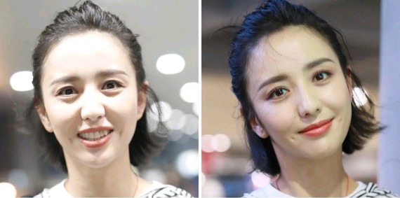 看一下佟丽娅在顶光照射下,苹果肌也饱满的像馒头.