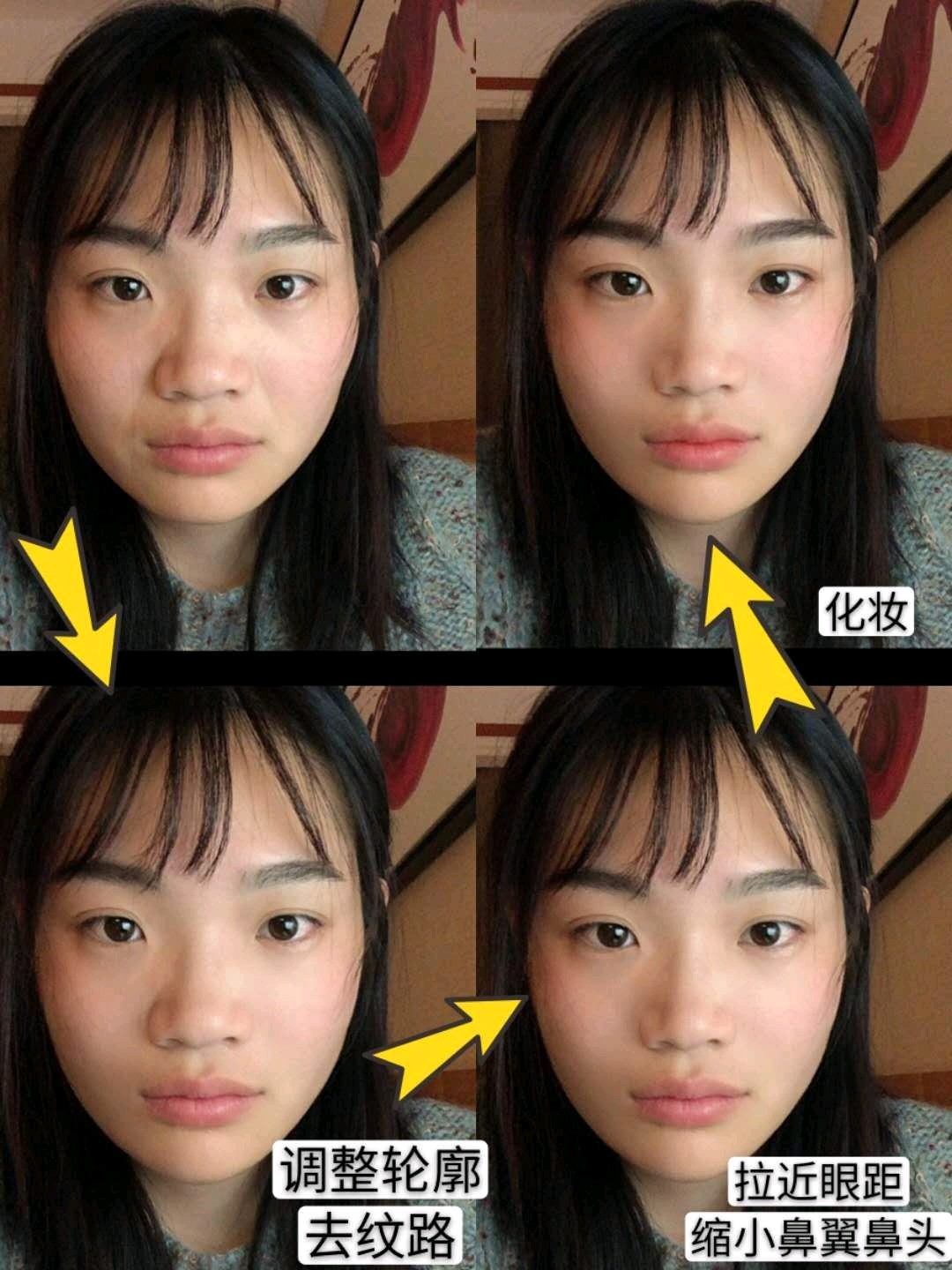 我是不是没救了塌鼻子眼距宽眼睛小发际线高哎