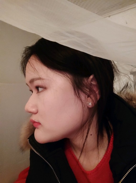 图片  提 交  相关评论 sasa010 鼻子山根高度可以做起来 侧面月亮脸