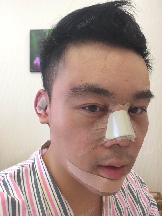 术后第二天拆了好多东西轻快