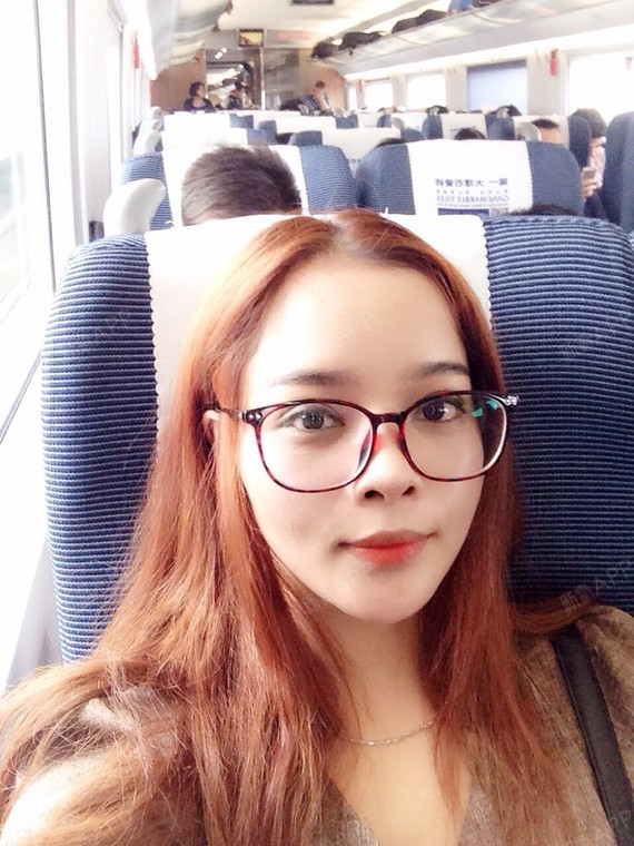 本人上嘴唇厚人中也不明显,笑起来看不出厚,不