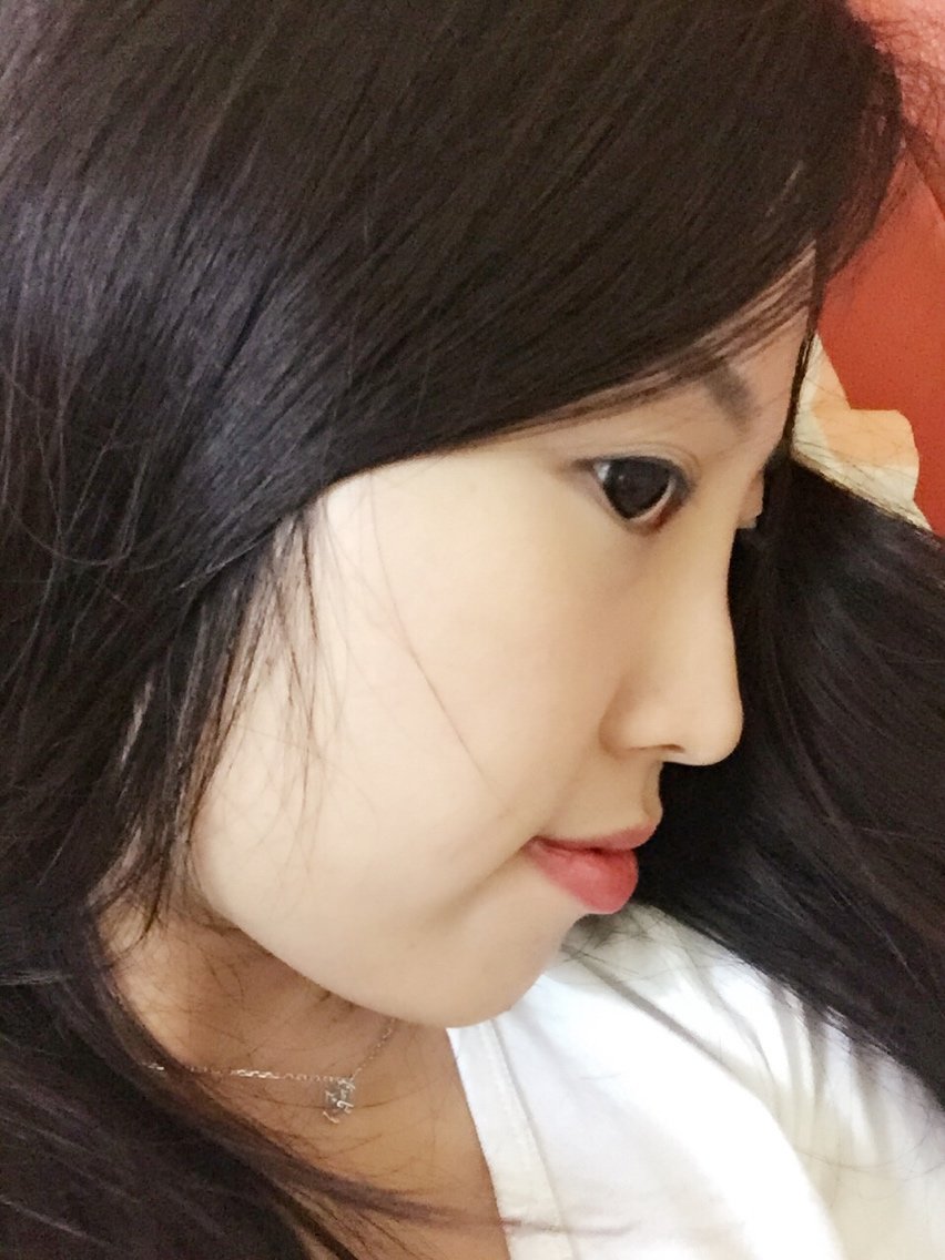 为什么鼻子从侧面看都是凹凸不平的?心塞!鼻梁正面看着很宽侧面形