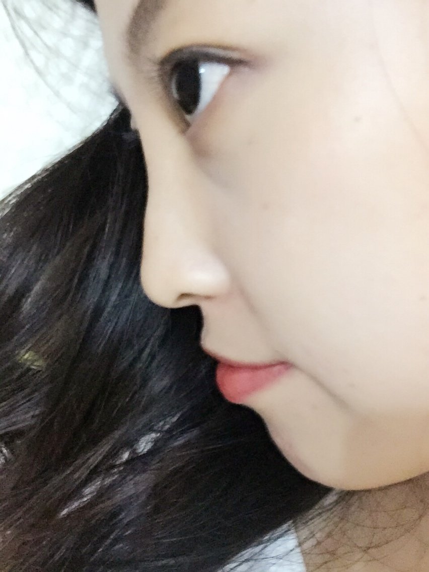 为什么鼻子从侧面看都是凹凸不平的?心塞!鼻梁正面看着很宽侧面形