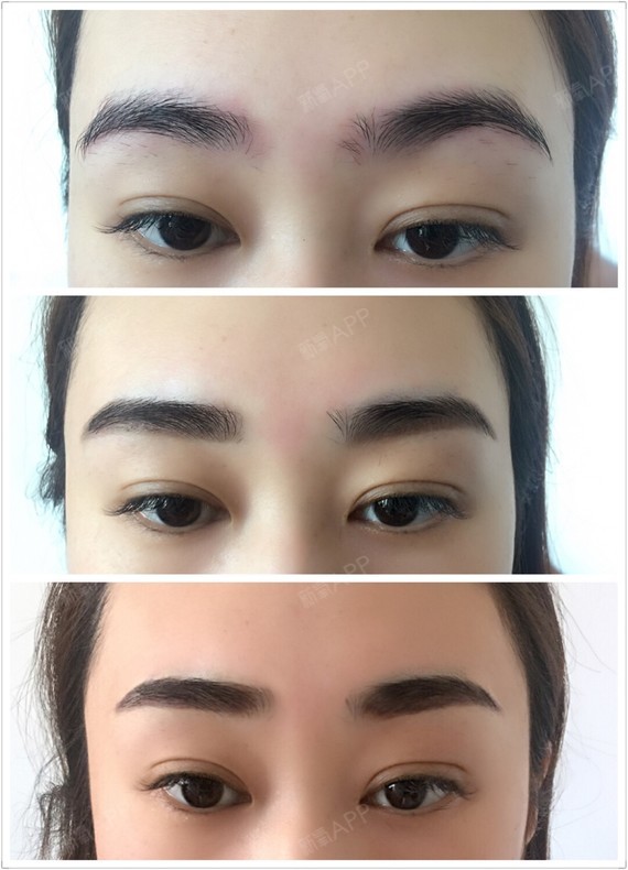 做完就很自然没有蜡笔小新恢复期的半永久温泉水雾定妆眉