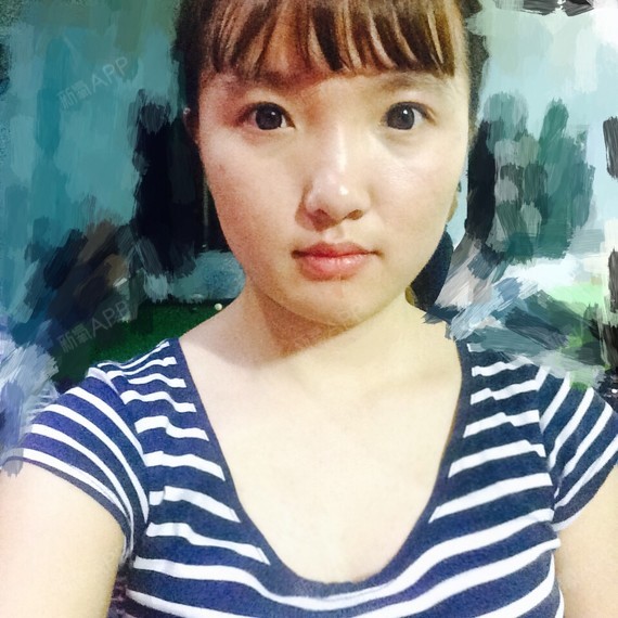 脸太圆鼻头大眼睛距离宽丑爆了我想整容大概费用是多少?