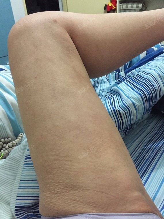 大腿纬度依然坚挺的留在了50!